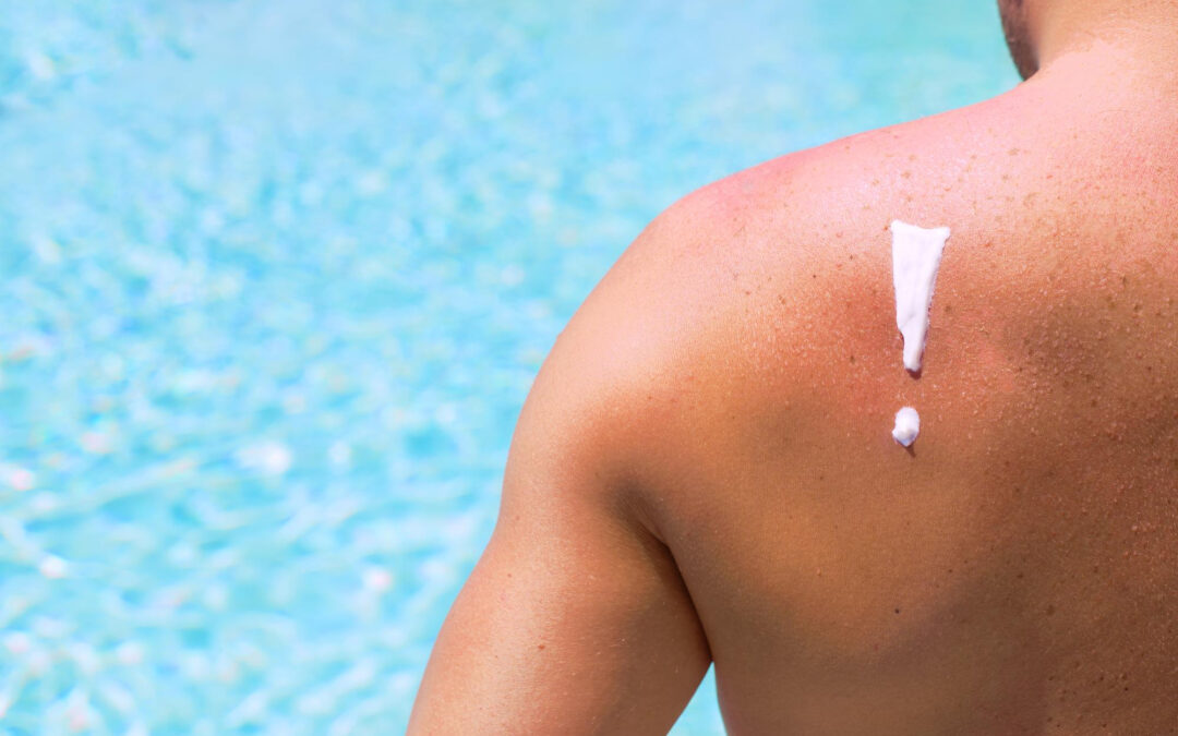 Shedding Light on Sun Damage: Is Lumecca by InMode Better than Traditional IPL?